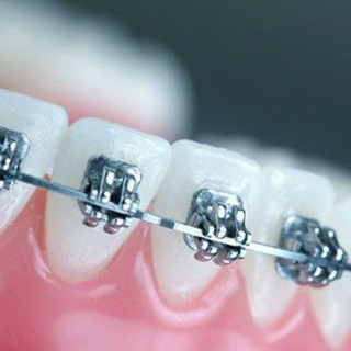 Orthodontics kfs