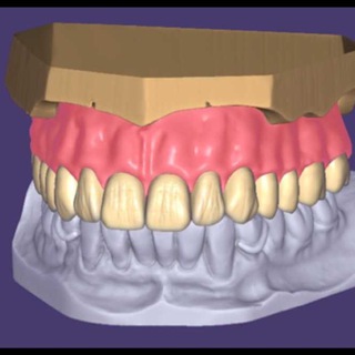 exocad-3shape-cerec expert